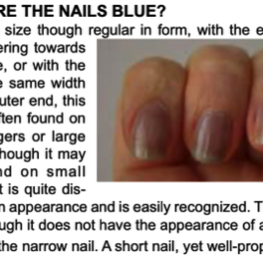 025_14 Blue nails